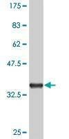 Anti-MAPKAPK3 Antibody