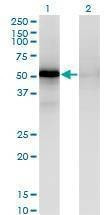 Anti-MAPKAPK5 Antibody
