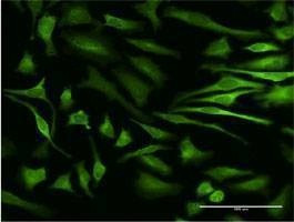 Anti-MAPKAPK5 Antibody