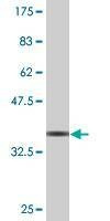 Anti-MAPRE3 Antibody