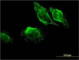 Anti-MAPRE3 Antibody