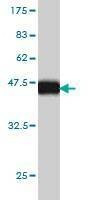 Anti-MCFD2 Antibody