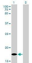 Anti-MCFD2 Antibody