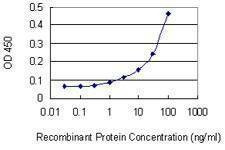 Anti-MCFD2 Antibody