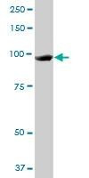 Anti-MCM3 Antibody