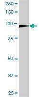 Anti-MCM3 Antibody