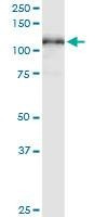 Anti-MCM3 Antibody