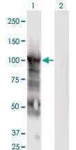 Anti-MCM6 Antibody
