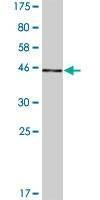 Anti-MCTS1 Antibody