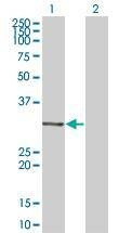 Anti-MDFI Antibody