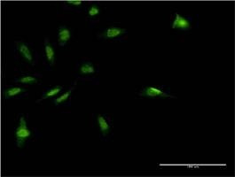 Anti-MDFI Antibody