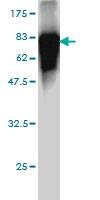 Anti-MDS028 Antibody