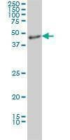 Anti-MDS028 Antibody