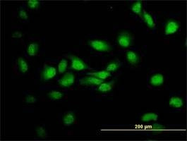 Anti-MDS028 Antibody