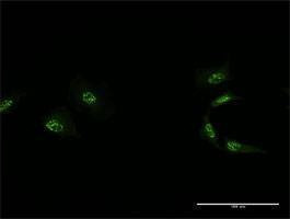 Anti-MED4 Antibody