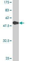 Anti-MED4 Antibody
