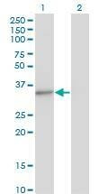 Anti-MED4 Antibody