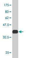 Anti-MEF2A Antibody