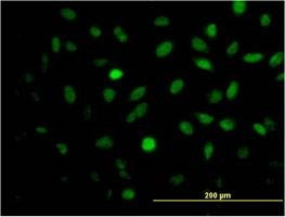 Anti-MEIS2 Antibody