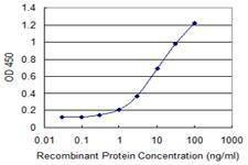 Anti-MGAT5 Antibody