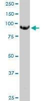 Anti-MGAT5 Antibody