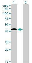 Anti-MGC26963 Antibody