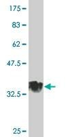 Anti-MGC26963 Antibody