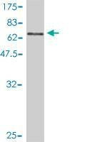 Anti-MGC3207 Antibody