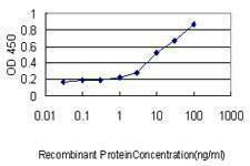 Anti-MGC3207 Antibody
