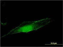 Anti-MGEA5 Antibody
