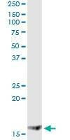 Anti-MGST2 Antibody