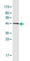 Anti-MID1IP1 Antibody
