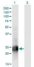 Anti-MID1IP1 Antibody