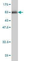 Anti-MKNK1 Antibody