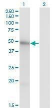 Anti-MKNK1 Antibody