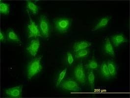 Anti-MKNK1 Antibody