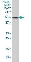 Anti-MKNK1 Antibody