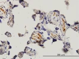 Anti-MKNK1 Antibody