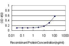 Anti-MKNK1 Antibody