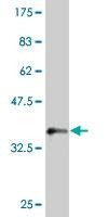 Anti-MKRN1 Antibody