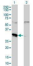 Anti-MLF2 Antibody
