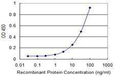 Anti-MLLT6 Antibody