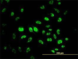 Anti-MPG Antibody