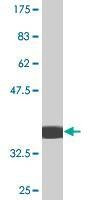 Anti-MPHOSPH10 Antibody