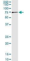 Anti-MPP2 Antibody