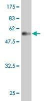 Anti-MSI2 Antibody