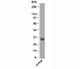 Anti-Bcl-X Antibody, Sodium Azide Free