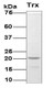 Recombinant Escherichia coli Thioredoxin Protein