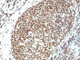Anti-Histone H1 Antibody
