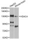 Anti-HDAC4 Antibody
